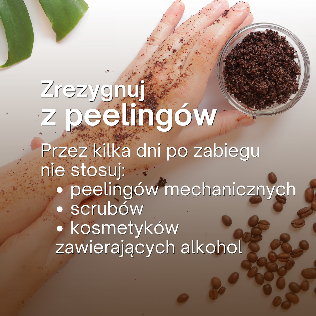Home epilare wskazówki 4